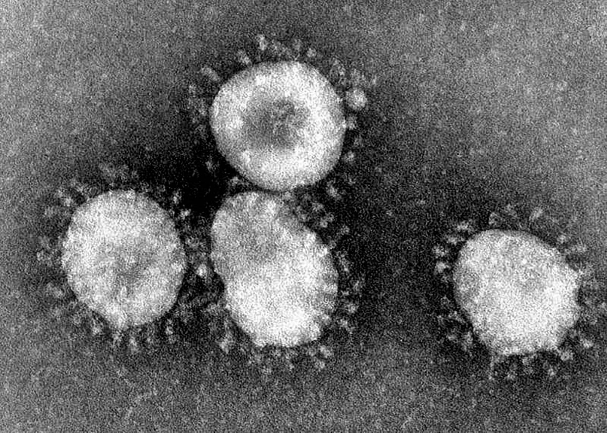 Virus de COVID-19, coronavirus.